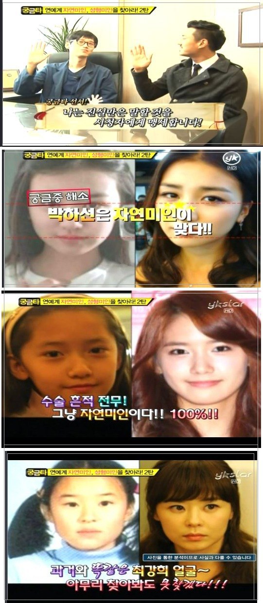 소녀시대 윤아 성형의 진실 | 인스티즈