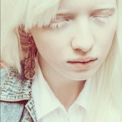 알비노모델 | 인스티즈