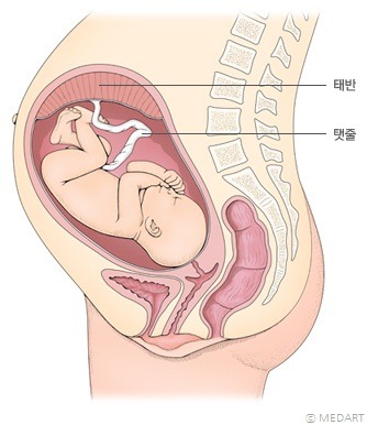 초음파 착시 사진 jpg | 인스티즈