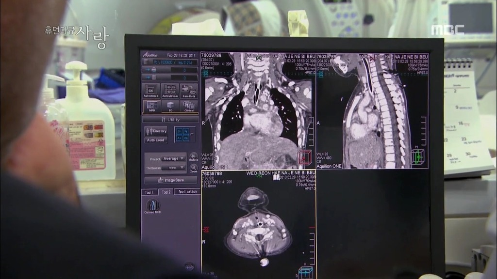 [다큐] 해나의 기적 -2- | 인스티즈