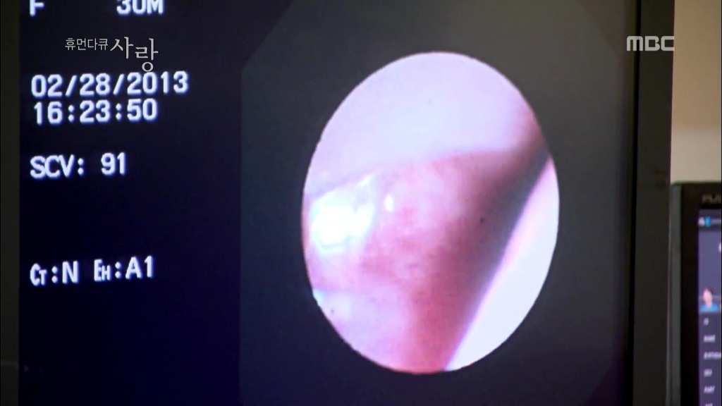 [다큐] 해나의 기적 -2- | 인스티즈