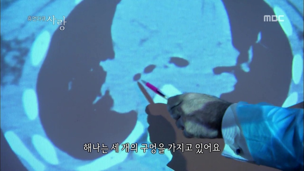 [다큐] 해나의 기적 -2- | 인스티즈