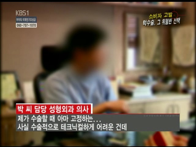 언니들!! 양악수술!!! 제대로 알아보고하자!!! | 인스티즈