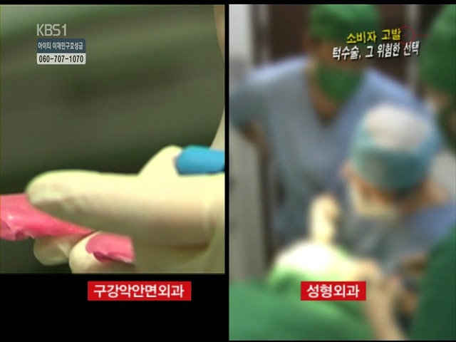 언니들!! 양악수술!!! 제대로 알아보고하자!!! | 인스티즈