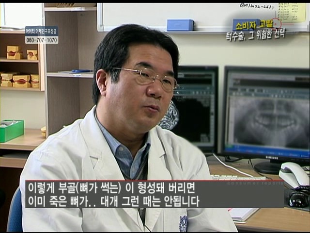 언니들!! 양악수술!!! 제대로 알아보고하자!!! | 인스티즈