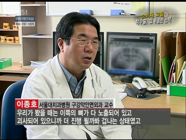 언니들!! 양악수술!!! 제대로 알아보고하자!!! | 인스티즈