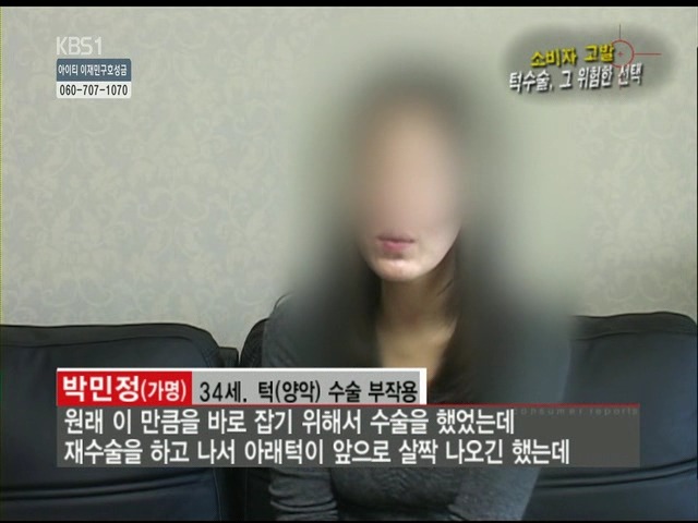 언니들!! 양악수술!!! 제대로 알아보고하자!!! | 인스티즈