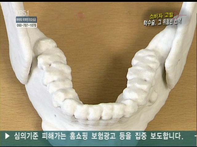 언니들!! 양악수술!!! 제대로 알아보고하자!!! | 인스티즈