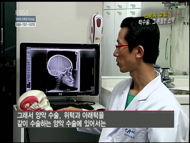 언니들!! 양악수술!!! 제대로 알아보고하자!!! | 인스티즈