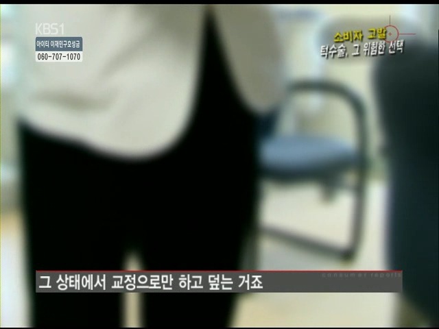 언니들!! 양악수술!!! 제대로 알아보고하자!!! | 인스티즈