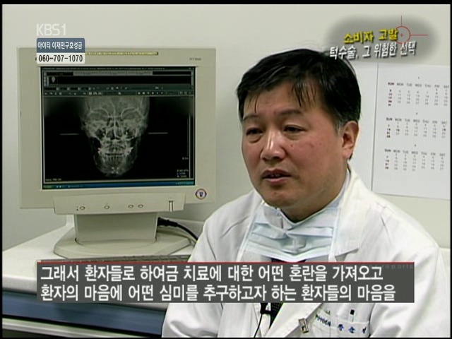 언니들!! 양악수술!!! 제대로 알아보고하자!!! | 인스티즈