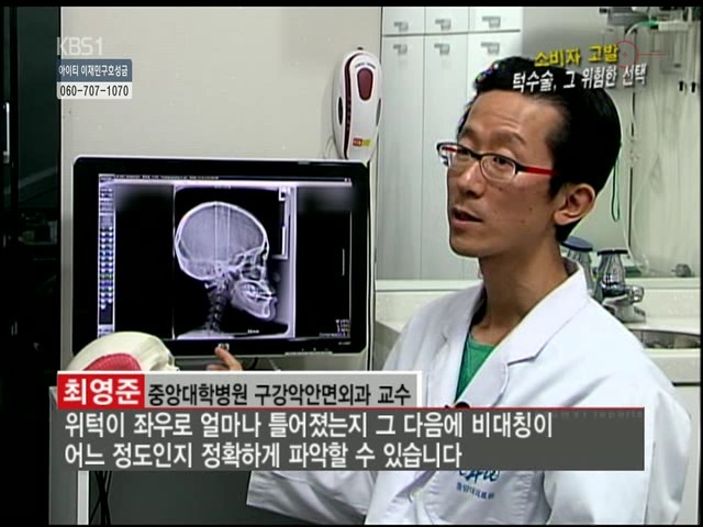 언니들!! 양악수술!!! 제대로 알아보고하자!!! | 인스티즈