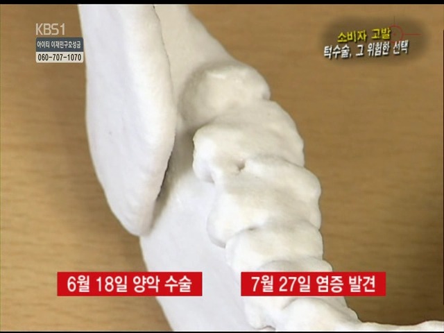 언니들!! 양악수술!!! 제대로 알아보고하자!!! | 인스티즈