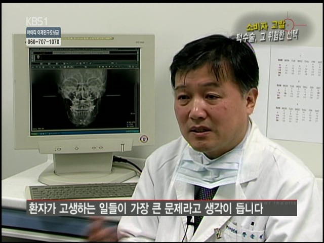 언니들!! 양악수술!!! 제대로 알아보고하자!!! | 인스티즈