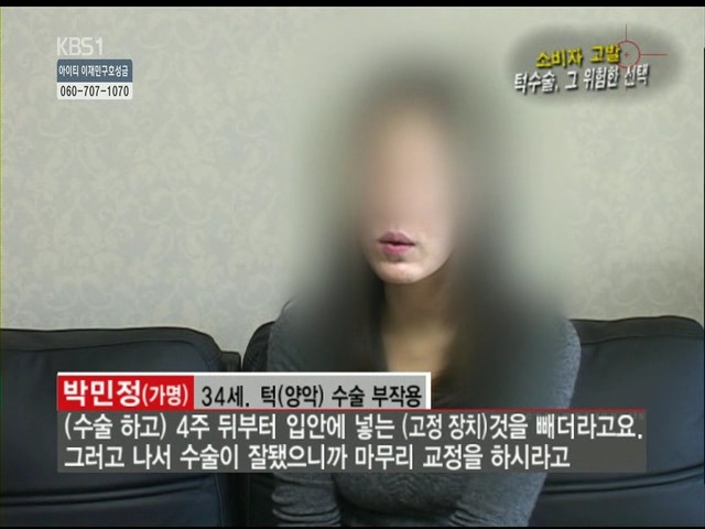 언니들!! 양악수술!!! 제대로 알아보고하자!!! | 인스티즈