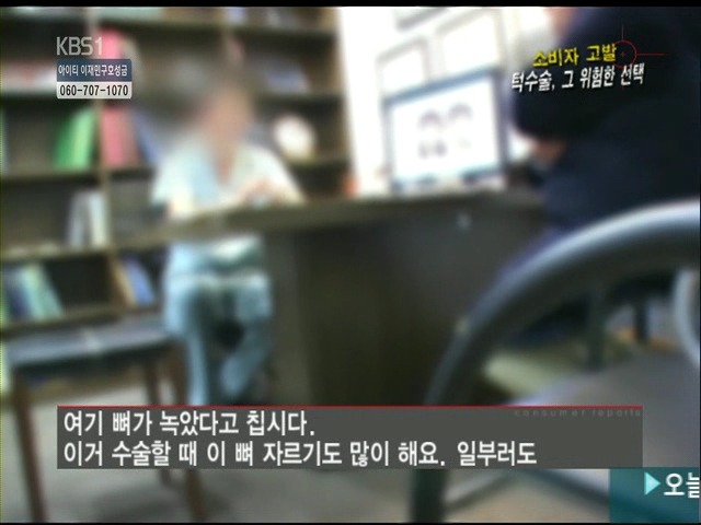 언니들!! 양악수술!!! 제대로 알아보고하자!!! | 인스티즈