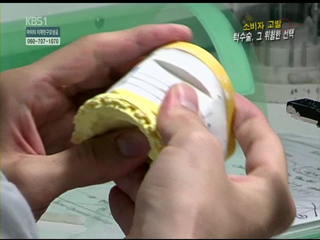 언니들!! 양악수술!!! 제대로 알아보고하자!!! | 인스티즈