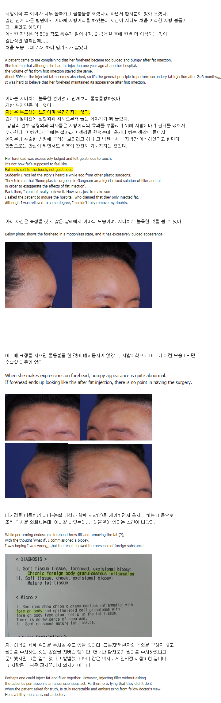 성형외과 의사가 쓴 칼럼이오. 강남얼굴/ 하지 말아야 할 8가지 수술/ 성형수술 후 부작용 | 인스티즈