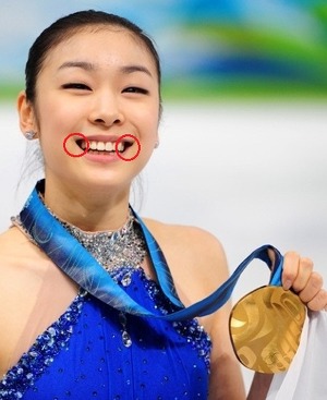 Image result for ìž…ë™êµ´