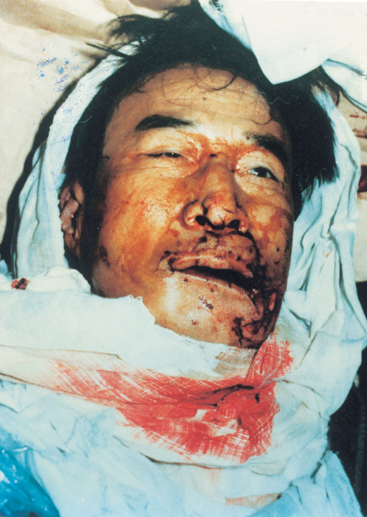 심약한분은 클릭금지 광주항쟁의 사진입니다 | 인스티즈