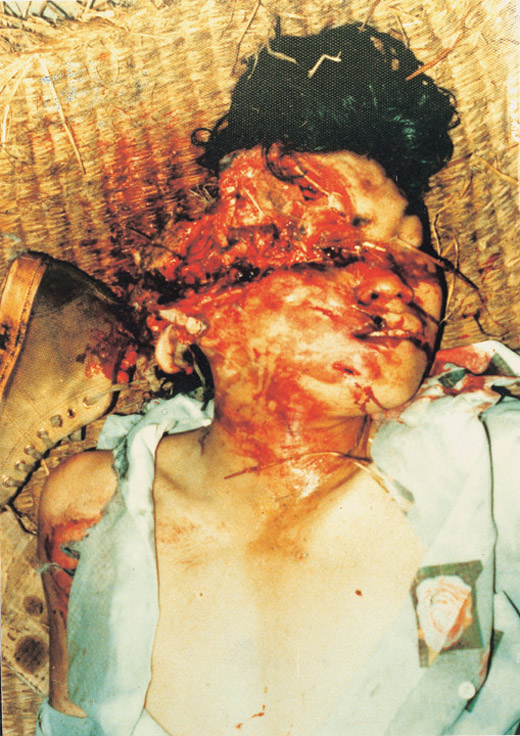 심약한분은 클릭금지 광주항쟁의 사진입니다 | 인스티즈